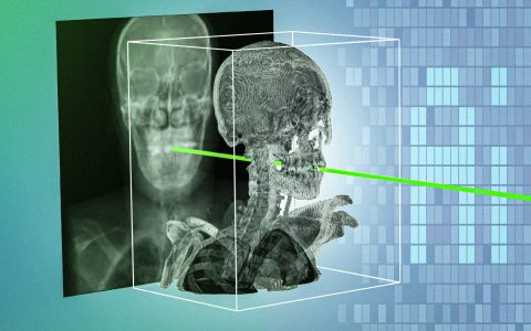 AI案例观察：New AI technique could make minimally invasive surgeries safer and more precise